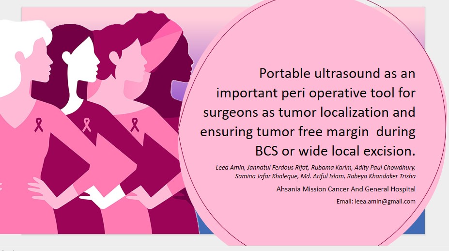Portable ultrasound as an important peri operative tool for surgeons as tumour localization and ensuring tumour free margin during BCS or wide local excision.